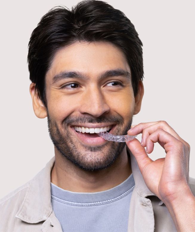 Man smiling while biting down on a Chomper Labs night guard.