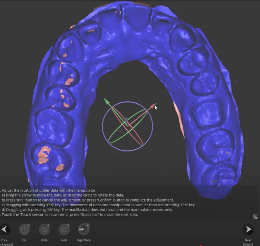 3D model of teeth after being scanned in preparation for making a custom mouth guard.